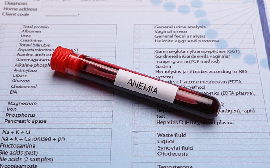 Anemia blood test