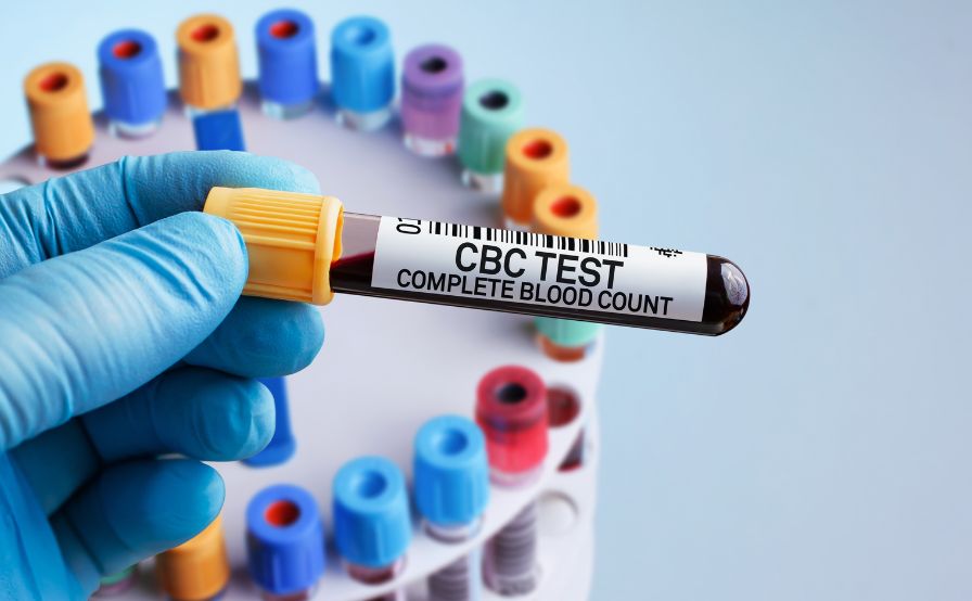 CBC blood tests Feature Image
